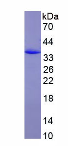 Recombinant Erythrocyte Membrane Protein Band 4.9 (EPB49)
