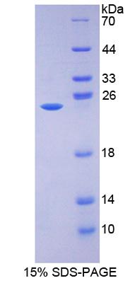 Recombinant 17-Beta-Hydroxysteroid Dehydrogenase Type 10 (HSD17b10)