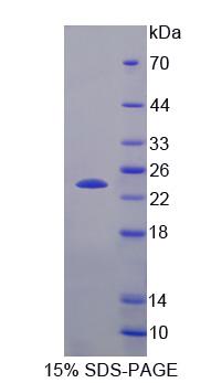 Recombinant Centrin 3 (CETN3)