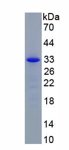 Recombinant Chloride Intracellular Channel Protein 2 (CLIC2)