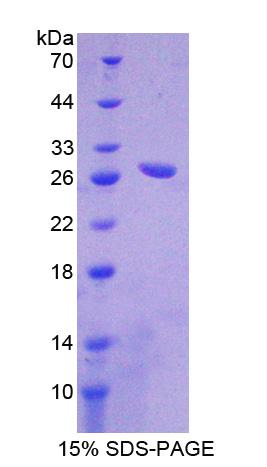 Recombinant Carboxypeptidase A1, Pancreatic (CPA1)