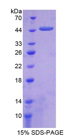 Recombinant Carboxypeptidase A2, Pancreatic (CPA2)