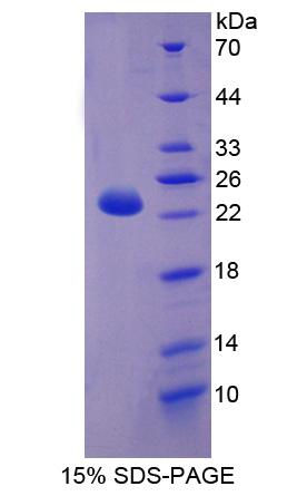 Recombinant Carnitine Palmitoyltransferase 1B, Muscle (CPT1B)