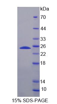 Recombinant Ferredoxin Reductase (FDXR)