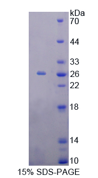 Recombinant Recoverin (RCVRN)