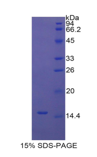 Recombinant Uncoupling Protein 1, Mitochondrial (UCP1)
