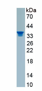 Recombinant Neuron Navigator 3 (NAV3)