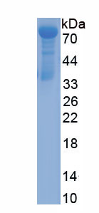 Recombinant Tumor Necrosis Factor Alpha Induced Protein 2 (TNFaIP2)