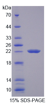 Recombinant Transient Receptor Potential Cation Channel Subfamily M, Member 7 (TRPM7)