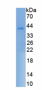 Recombinant Adenosine A1 Receptor (ADORA1)