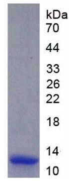 Recombinant Purinergic Receptor P2Y, G Protein Coupled 2 (P2RY2)