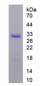 Recombinant Prolyl tRNA Synthetase 2, Mitochondrial (PARS2)