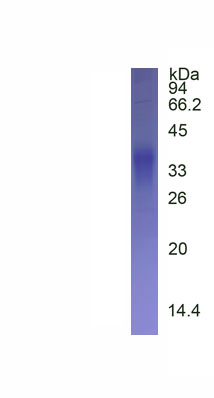 Recombinant Dedicator Of Cytokinesis 5 (DOCK5)