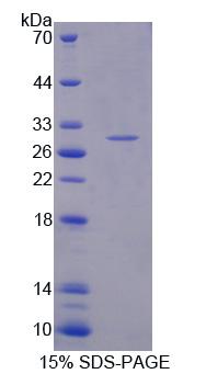 Recombinant Proteasome Subunit Alpha Type 5 (PSMa5)
