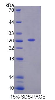 Recombinant Proteasome Subunit Alpha Type 7 (PSMa7)