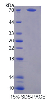 Recombinant Proteasome 26S Subunit, Non ATPase 4 (PSMD4)