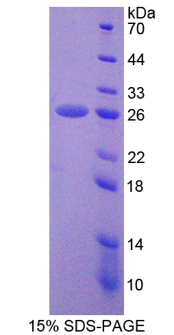 Recombinant Proteasome 26S Subunit, Non ATPase 5 (PSMD5)