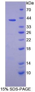 Recombinant Proteasome 26S Subunit, Non ATPase 7 (PSMD7)
