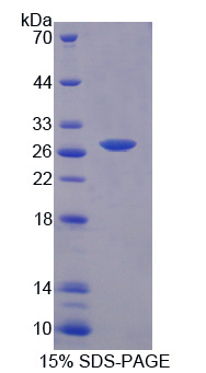 Recombinant Protein Kinase, AMP Activated Gamma 3 (PRKAg3)