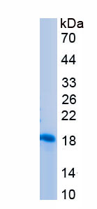 Recombinant Pregnancy Zone Protein (PZP)