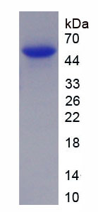 Recombinant Lipin 1 (LPIN1)