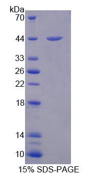 Recombinant Steroid Sulfatase Isozyme S (STS)