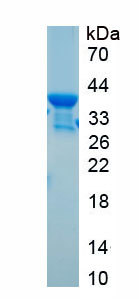 Recombinant Triggering Receptor Expressed On Myeloid Cells 2 (TREM2)