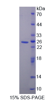 Recombinant Visinin Like Protein 1 (VSNL1)