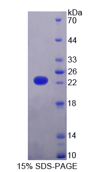 Recombinant Lysine Specific Demethylase 4A (KDM4A)