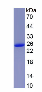 Recombinant Ubiquinol Cytochrome C Reductase Core Protein I (UQCRC1)