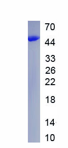 Recombinant Ubiquinol Cytochrome C Reductase Core Protein II (UQCRC2)