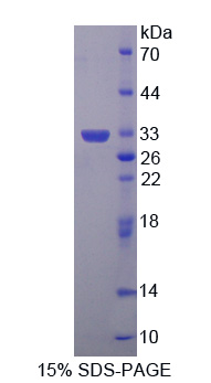 Recombinant Glutaredoxin 3 (GLRX3)