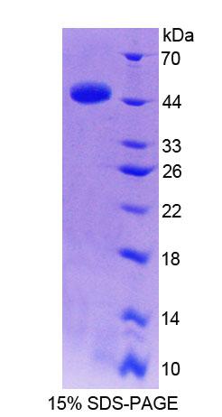 Recombinant Thyroid Hormone Receptor Interactor 6 (TRIP6)