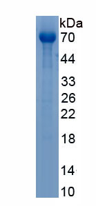 Recombinant Transglutaminase 6 (TGM6)