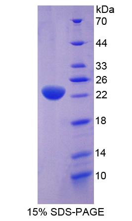 Recombinant Stress Induced Phosphoprotein 1 (STIP1)