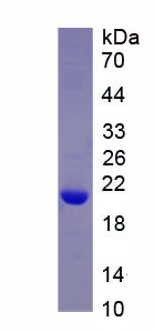 Recombinant Suppressors Of Cytokine Signaling 6 (SOCS6)