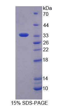 Recombinant Single Strand Selective Monofunctional Uracil DNA Glycosylase 1 (SMUG1)