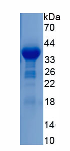 Recombinant Polyglutamine Binding Protein 1 (PQBP1)