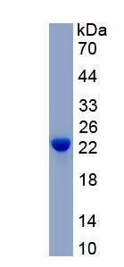 Recombinant Pro-Melanin Concentrating Hormone (PMCH)