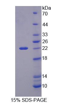 Recombinant PHD Finger Protein 8 (PHF8)