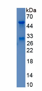 Recombinant Neurogenic Differentiation 1 (NEUROD1)