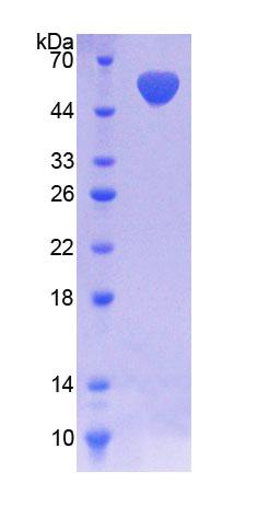 Recombinant NAD Kinase (NADK)