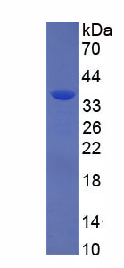 Recombinant Myocilin (MYOC)