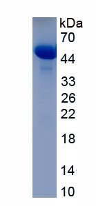 Recombinant Melanoma Associated Antigen 1 (MUM1)