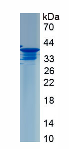 Recombinant Liver Expressed Antimicrobial Peptide 2 (LEAP2)