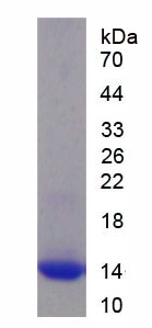 Recombinant Hepatitis B Virus X Interacting Protein (HBXIP)