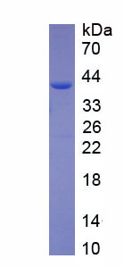 Recombinant Cysteine Rich Transmembrane BMP Regulator 1 (CRIM1)