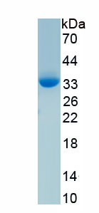 Recombinant Choroideremia (CHM)