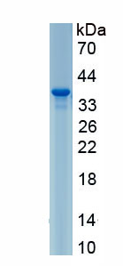 Recombinant Bcl2/Adenovirus E1B 19kDa Interacting Protein 3 (BNIP3)
