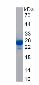 RPJ598Hu01.jpg